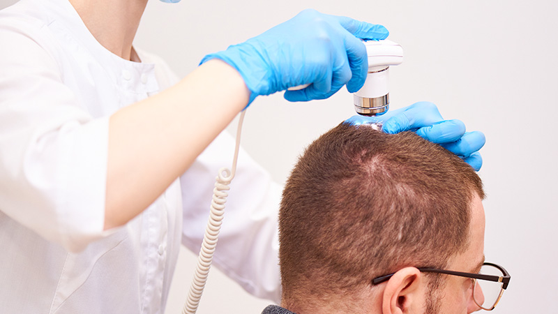 FUE hair transplant in 2026 